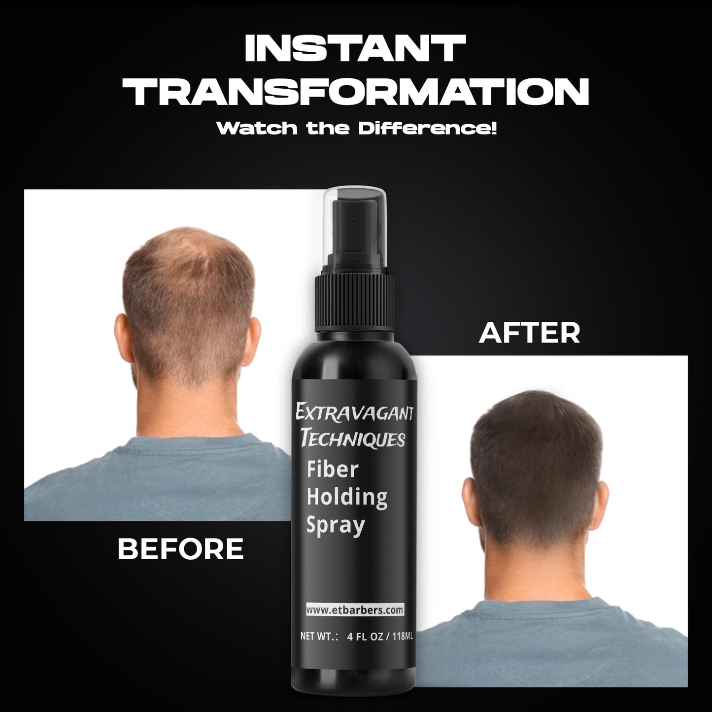Fiber Holding Spray for Hair – Wind & Water Resistant, Strong Bond for Hair Fibers – Quick-Dry, Flake-Free, Sweatproof, Humidity Control – Locks in Look for Bald Spots, Thinning Hair & Beards – 4 Oz.