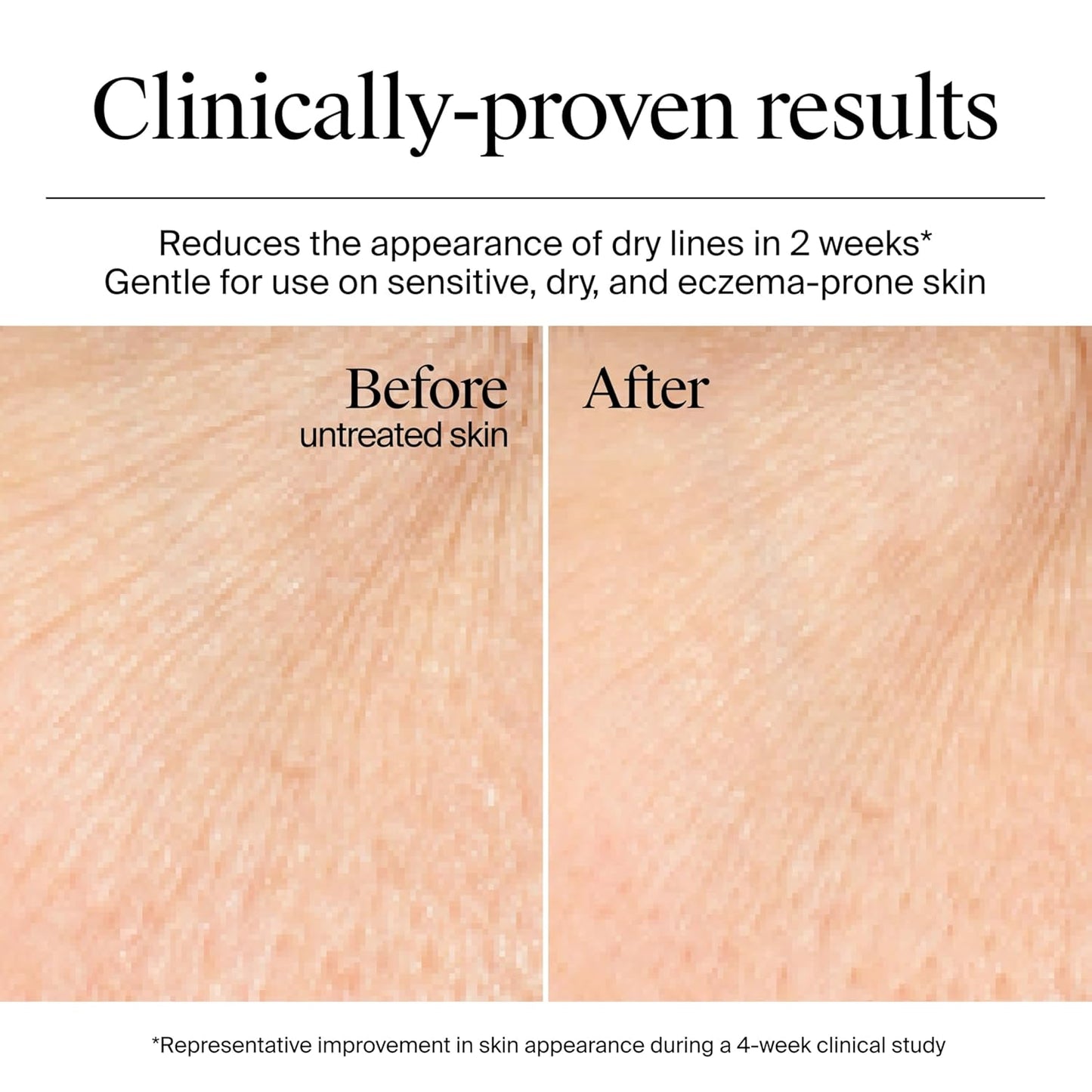 Hydro Boost Gel Cream, 48 Hr Hydration for Normal/Dry Skin, Fragrance Free, Face Moisturizer with Hyaluronic Acid, 1.7 Oz. & Trial Size Hydro Boost Hydrating Gel Cleanser, 0.5 Fl Oz